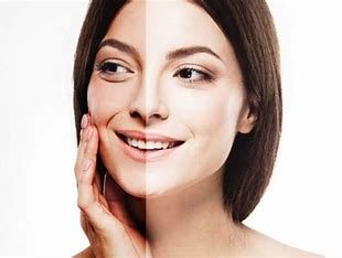 how to remove sun tan from face