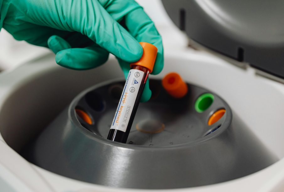 what is ast in blood test